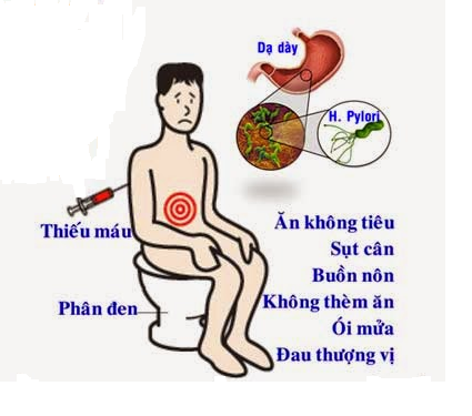 tam-soat-ung-thu-da-day-1