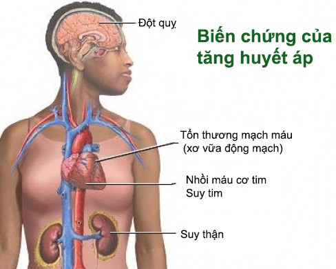 nhung luu y khi dieu tri tang huyet ap 2