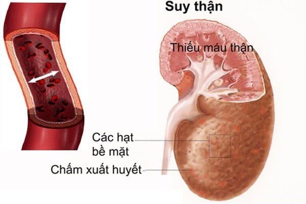 10 dau hieu canh bao benh 1