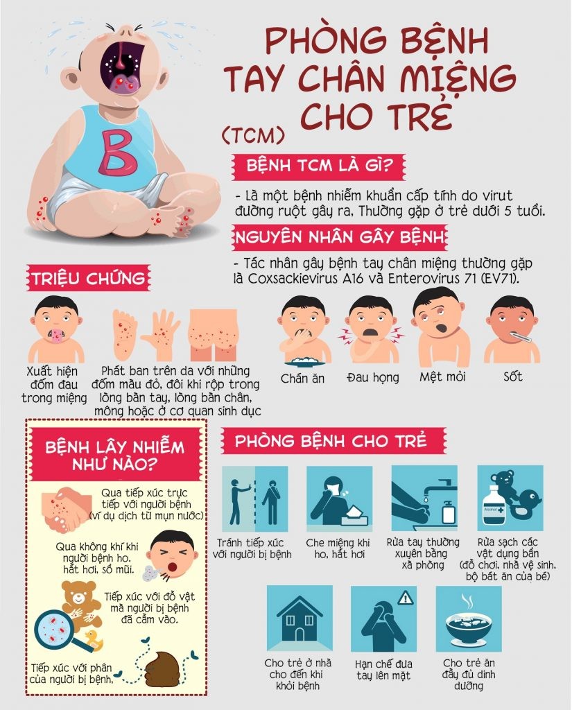 tre bi tay chan mieng phai lam sao 2 825x1024 1