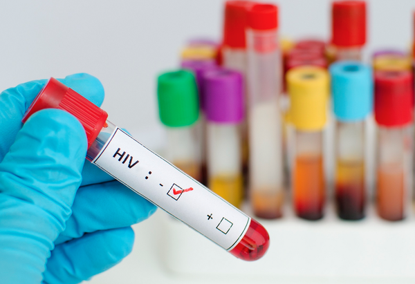 Nên xét nghiệm HIV ag/ab combi ở đâu bệnh viện nào?  Hữu Nghị Lạc Việt Vĩnh Phúc