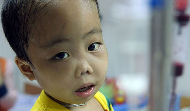 thalassemia benh vien huu nghi lac viet