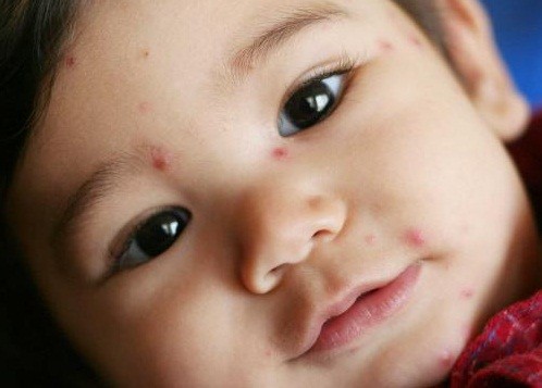 sau tet thuy dau vao mua11425358215