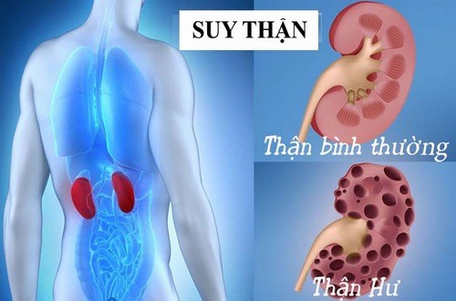 suy than co chua khoi duoc khong 2