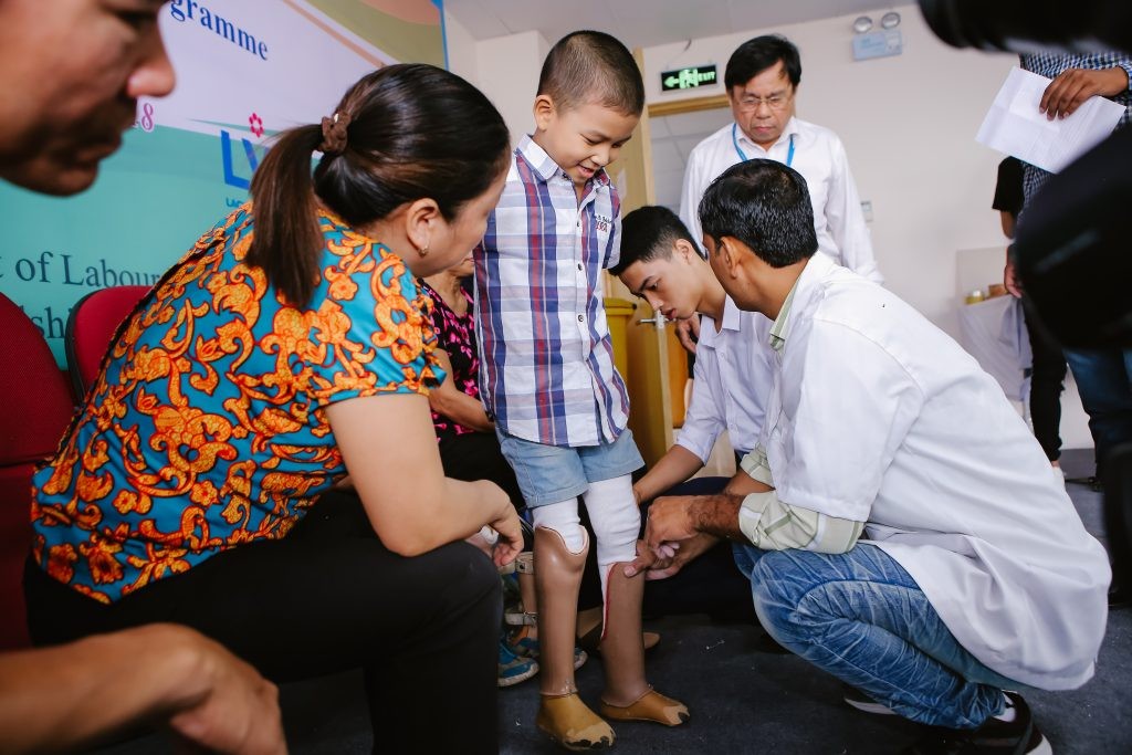 Bệnh viện Hữu Nghị Lạc Việt : chính thức khởi động dự án Trại lắp chân giả cho người khuyết tật 1 IMG 3183 1024x683 1