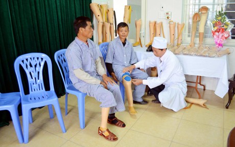 lắp chân giả