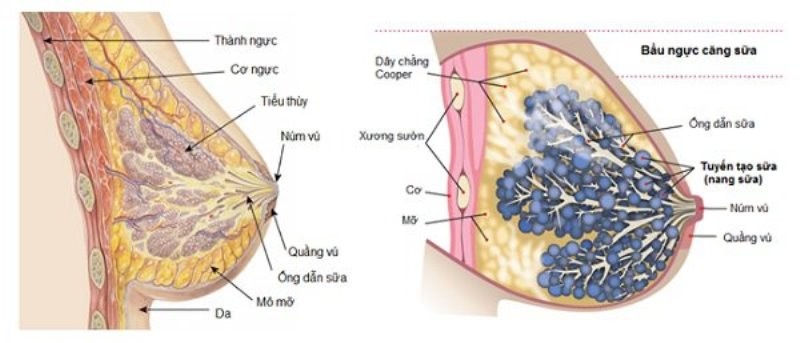 Điều trị viêm tắc tia sữa 1 dieu tri viem tac tia sua bang cham cuu va dung thuoc dong y 1