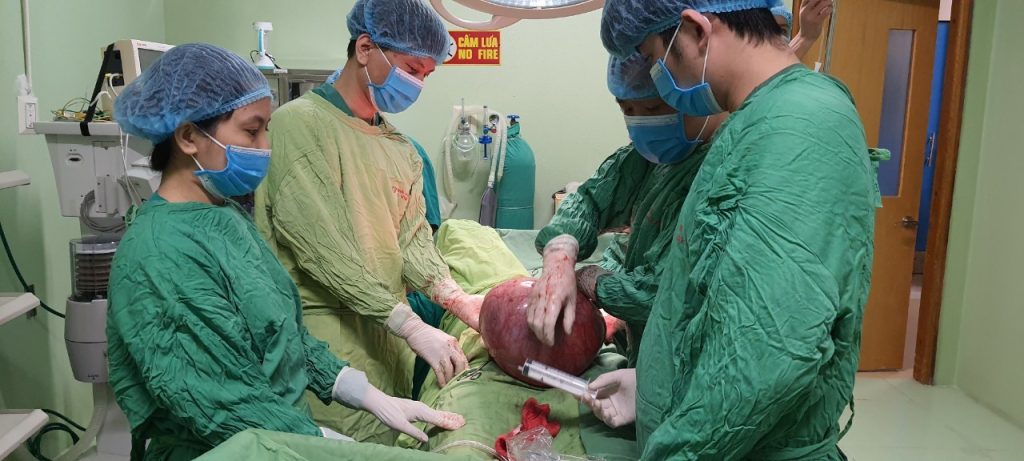 PHẪU THUẬT LẤY KHỐI U NẶNG ĐẾN 7.8KG CHO BỆNH NHÂN 50 TUỔI