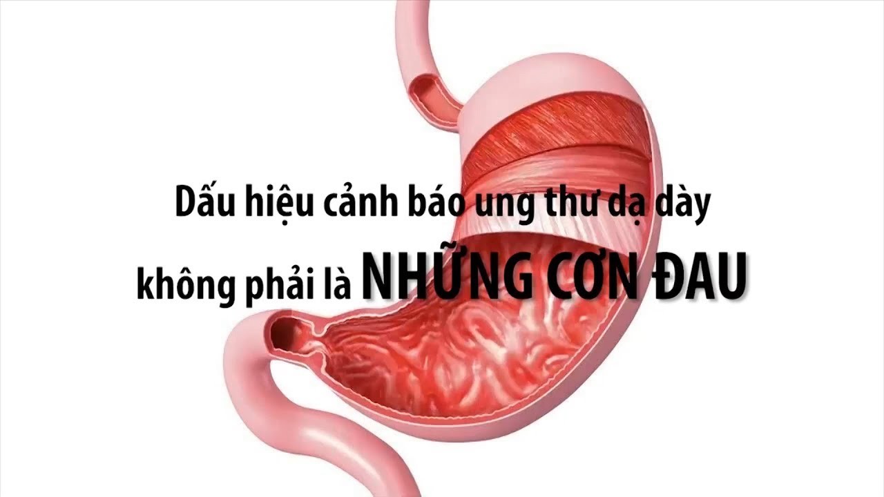dau hieu ung thu da day