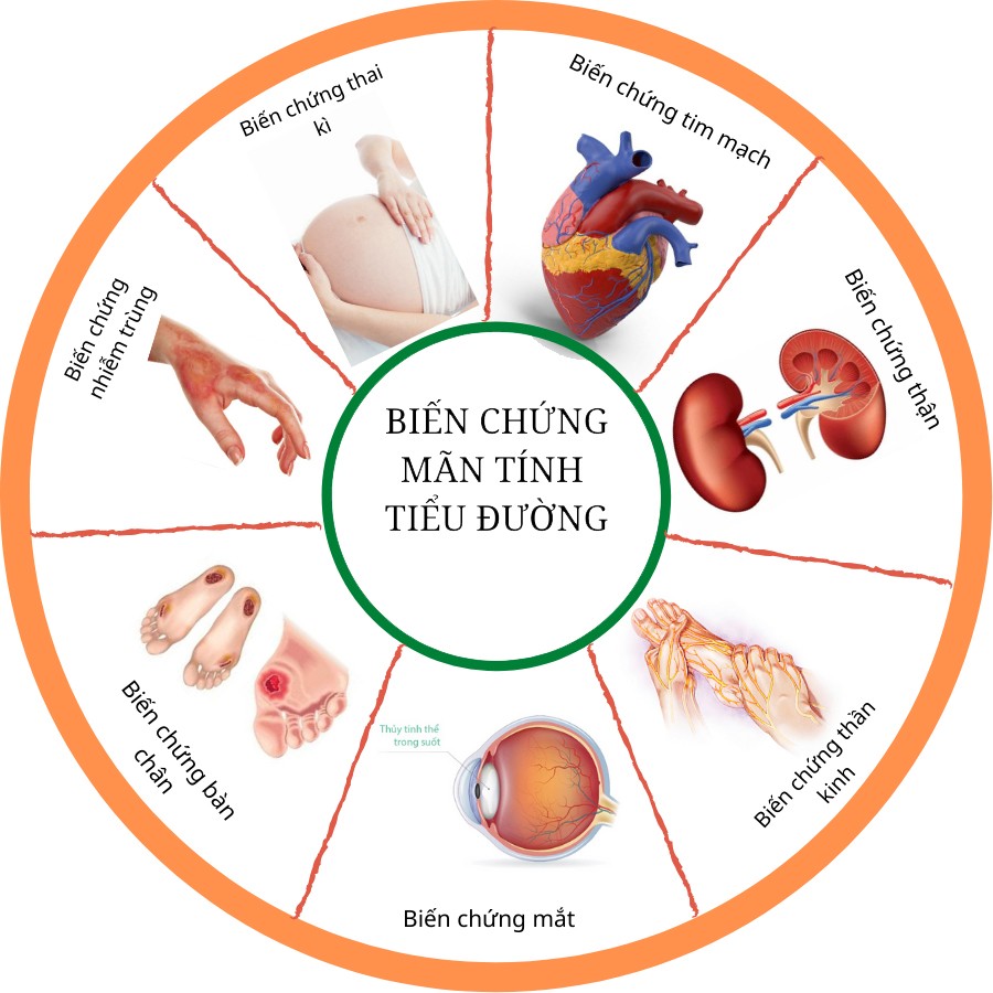 Bien Chung Man Tinh Tieu Duong