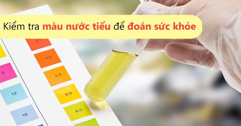 NƯỚC TIỂU MÀU NÂU – TUYỆT ĐỐI ĐỪNG CHỦ QUAN