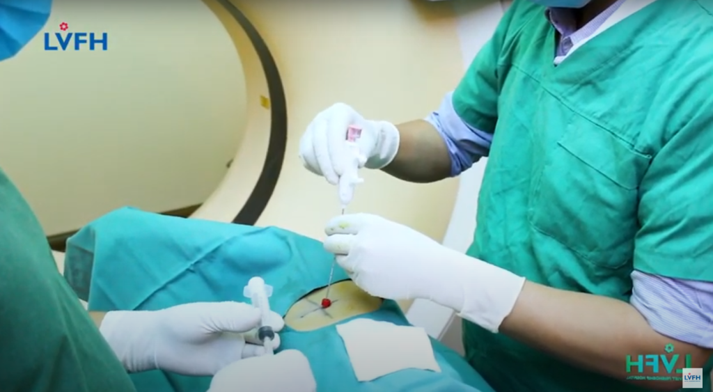 Phát hiện nhiều trường hợp ung thư nhờ sinh thiết phổi