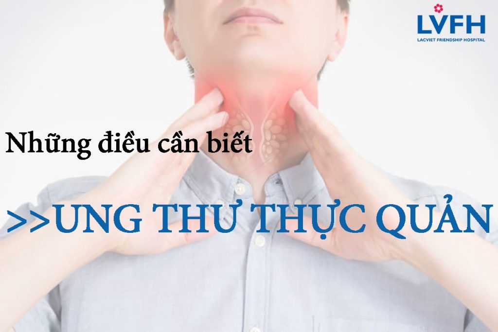 NHỮNG ĐIỀU CẦN BIẾT VỀ UNG THƯ THỰC QUẢN