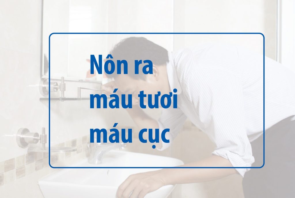 Bệnh nhân nôn ra máu tươi và máu cục, kết quả nội soi tiêu hóa khiến nhiều người bàng hoàng