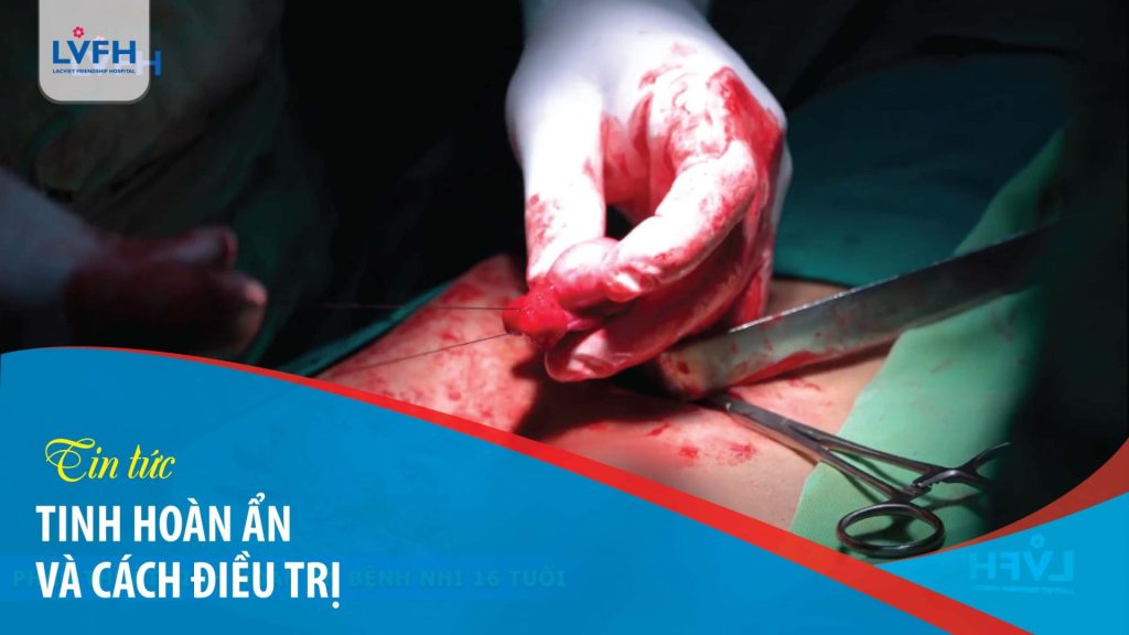 Phẫu thuật hạ tinh hoàn cho bệnh nhân 16 tuổi