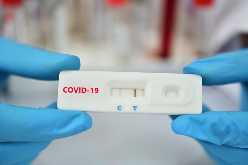 Từ ngày 15.7 test nhanh Covid không cần giấy giới thiệu