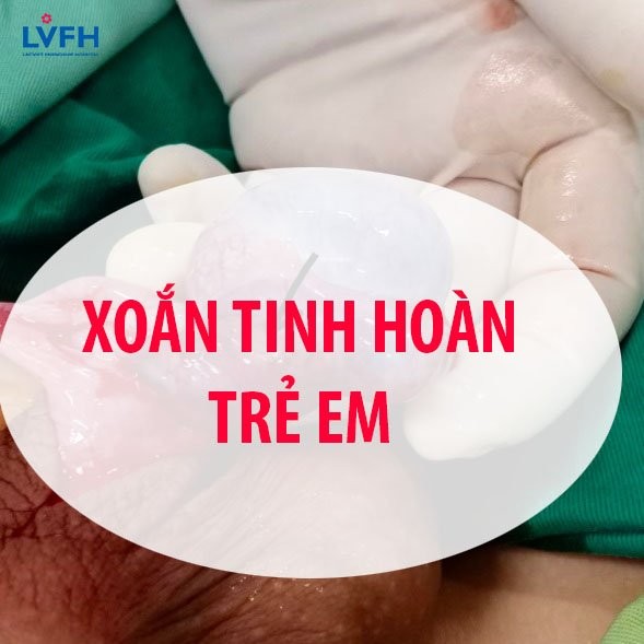 MỘT TRƯỜNG HỢP XOẮN TINH HOÀN ĐƯỢC CHẨN ĐOÁN VÀ PHẪU THUẬT SỚM TẠI BỆNH VIỆN LẠC VIỆT