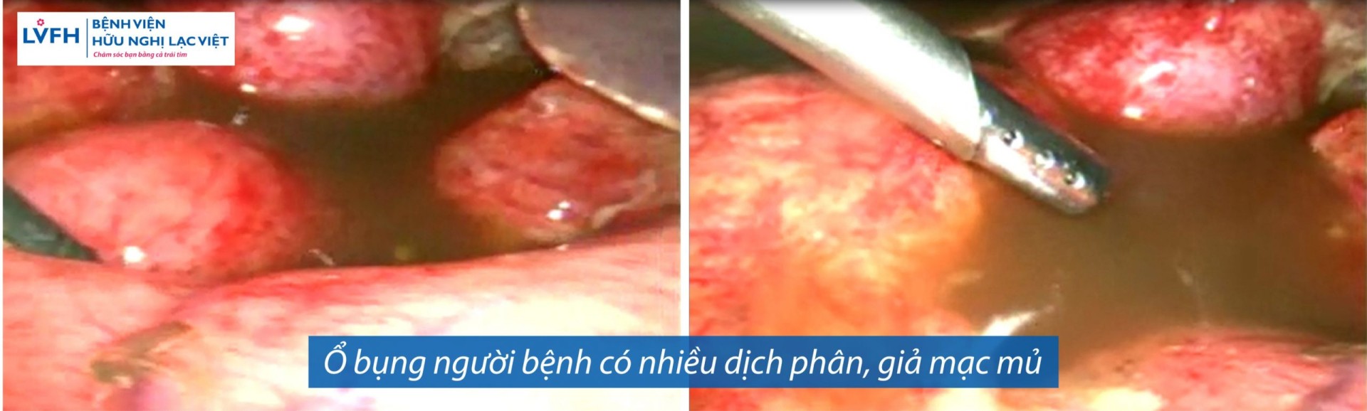 E120d6226076ad28f467