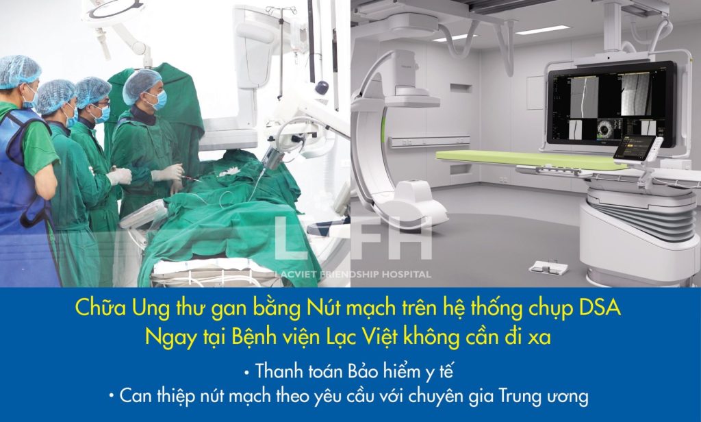 Chữa Ung thư gan bằng phương pháp Nút mạch trên hệ thống chụp DSA tại Bệnh viện Lạc Việt