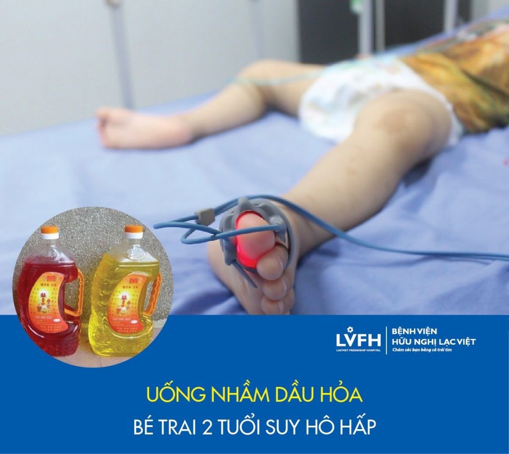 Uống Dầu Hỏa