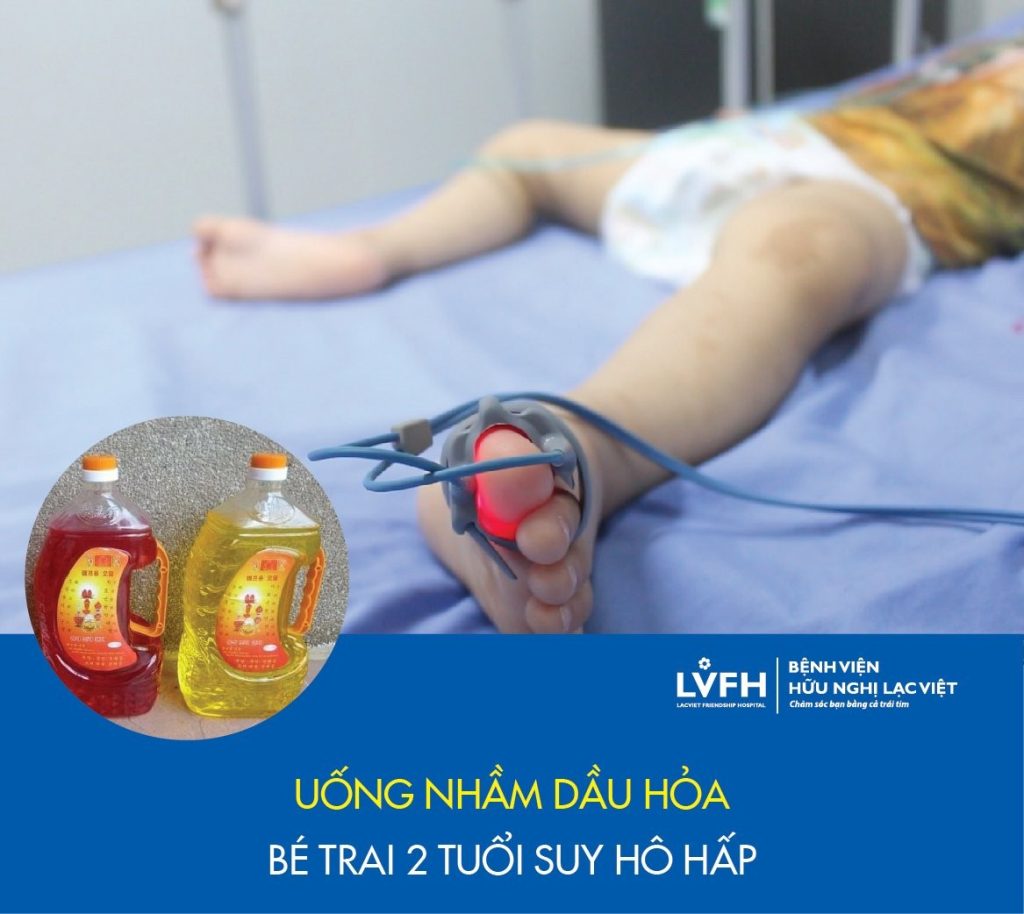 UỐNG NHẦM DẦU HỎA, BÉ TRAI 2 TUỔI SUY HÔ HẤP