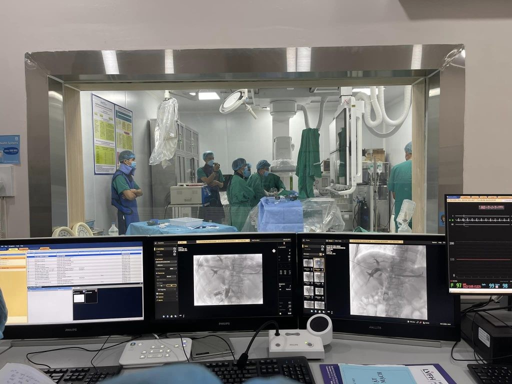 Tán Sỏi Mật Qua Da 2