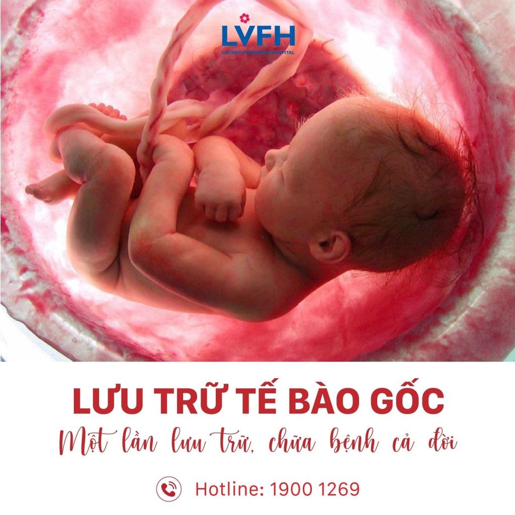 tế bào gốc bệnh viện hữu nghị Lạc Việt