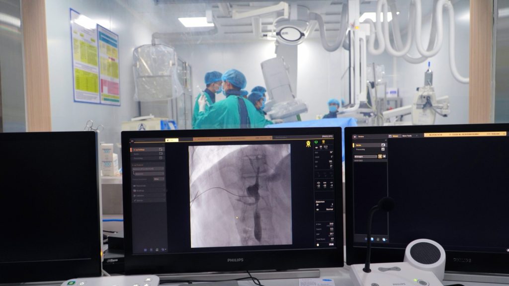 Tán sỏi đường mật trong gan qua da dưới hướng dẫn của hệ thống DSA – Phương pháp mới trong điều trị sỏi đường mật