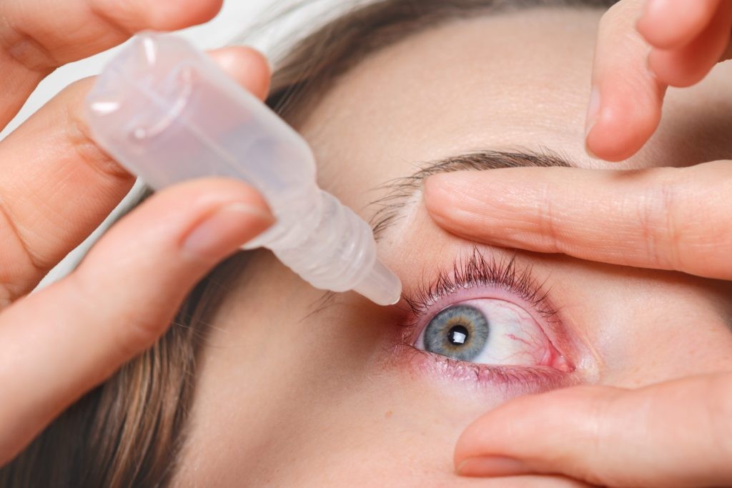 close up female pours drops red eye has conjuctivitis glaucoma bad eyesight pain eyes pain treatment concept woman cures red blood eye 1024x683 1