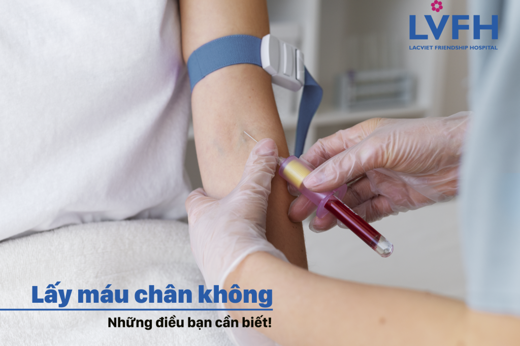 Lấy máu chân không – Phương pháp đột phá trong xét nghiệm – Tại Bệnh viện hữu nghị Lạc Việt