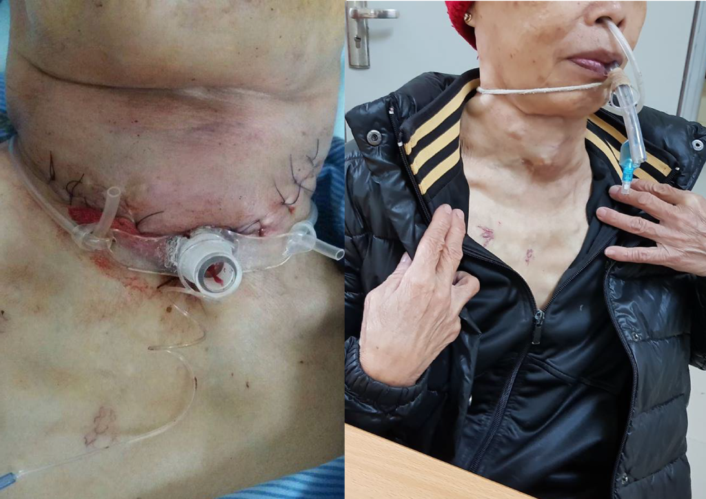 PT MNKQ 01 1024x724 1