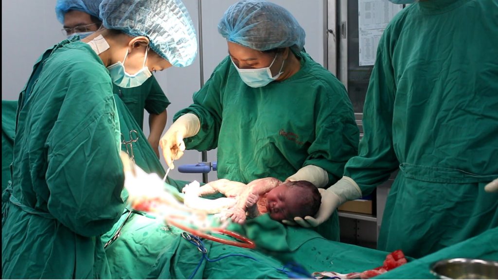 Mổ lấy thai cấp cứu cho sản phụ 35 tuần ối vỡ non, tiền sản giật nặng