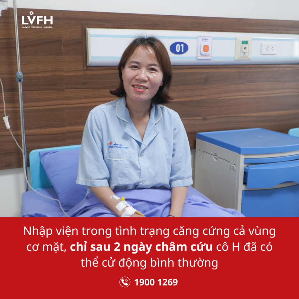 Căng cứng cả vùng cơ mặt, chỉ sau 2 ngày châm cứu đã có thể cử động bình thường
