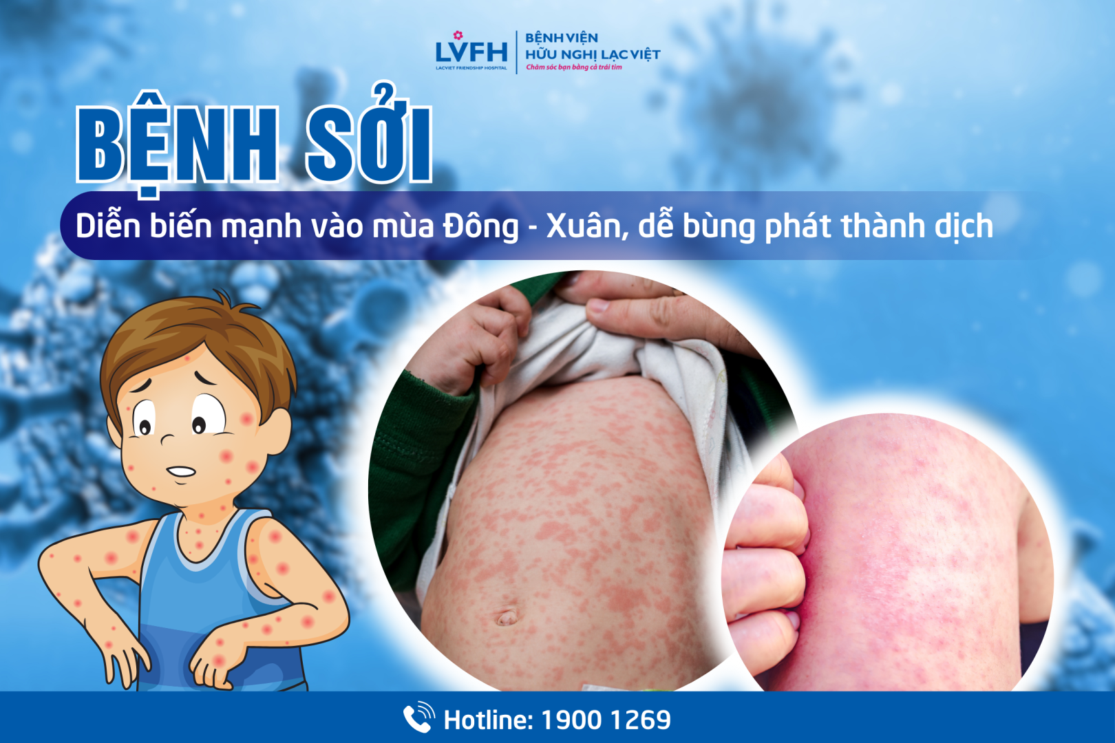 benh soi 1