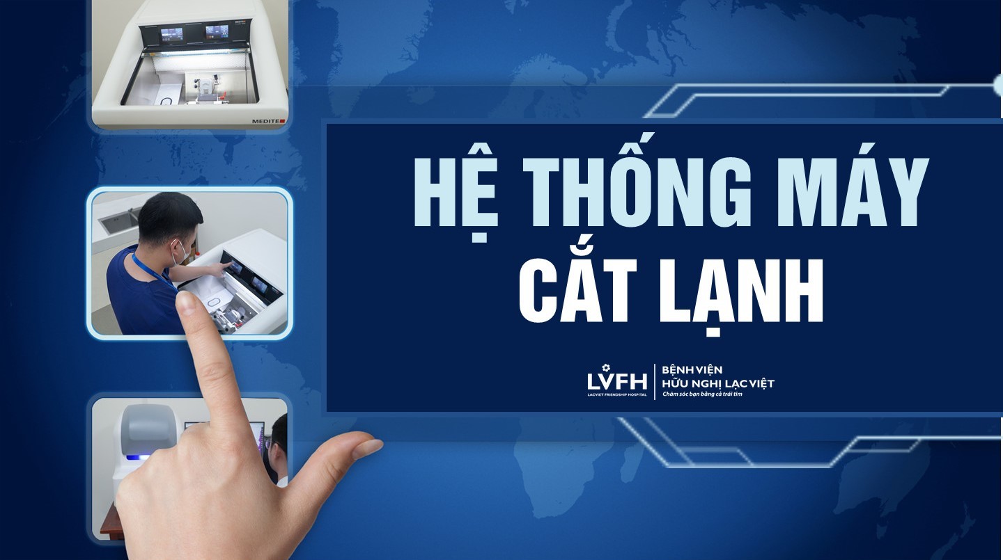 May Cat Lanh