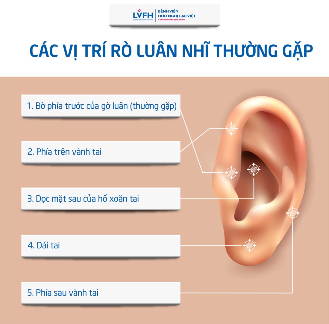 ro luan nhi 2