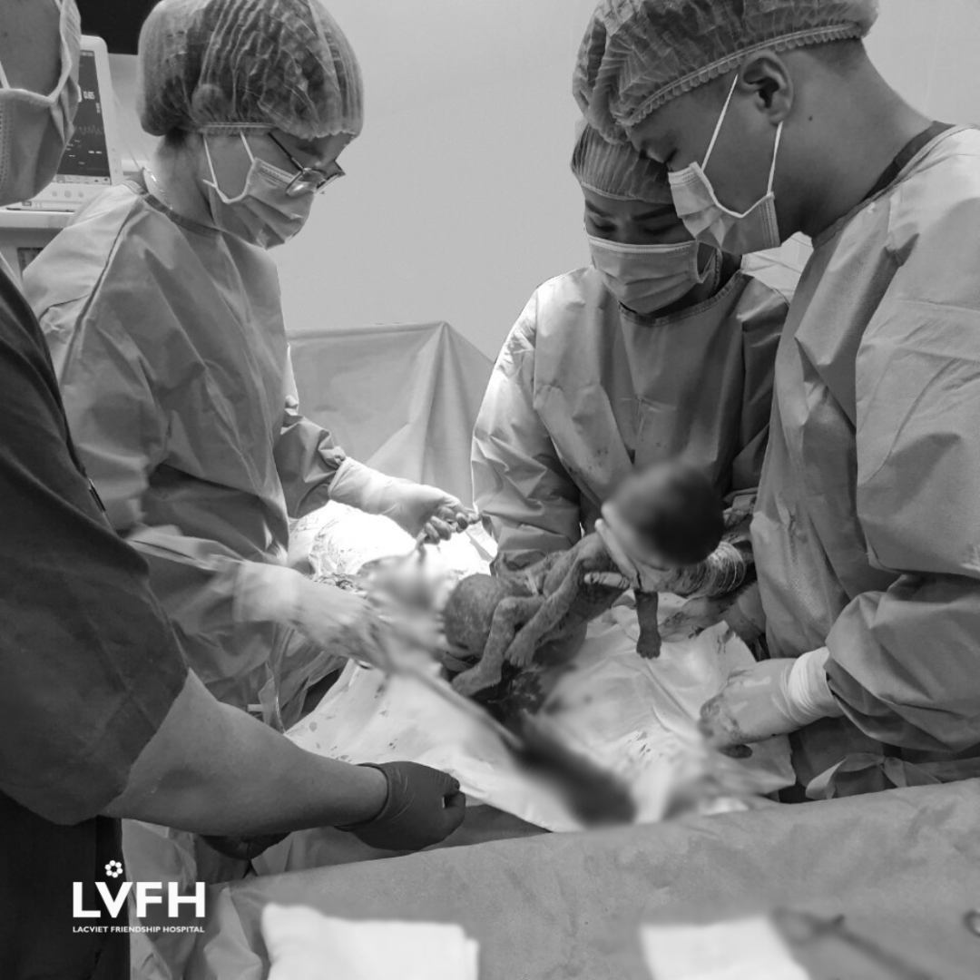 Bé sơ sinh chào đời với khối U quái “khổng lồ” vùng cùng cụt hiếm gặp 2 Ekip Bệnh viện hữu nghị Lạc Việt tiến hành phẫu thuật mổ lấy thai cho sản phụ L.T.T