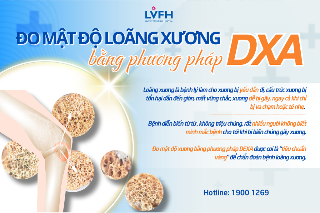 Đo mật độ loãng xương bằng phương pháp DXA được coi là "tiêu chuẩn vàng" trong chẩn đoán loãng xương.