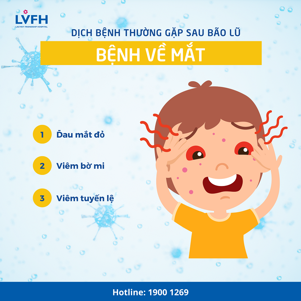 benh mat