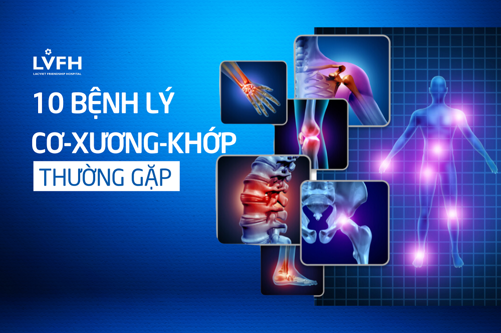 10 bệnh lý cơ xương khớp thường gặp ở Việt Nam