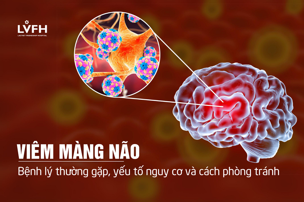 Viêm màng não: các bệnh lý thường gặp, yếu tố nguy cơ và cách phòng tránh