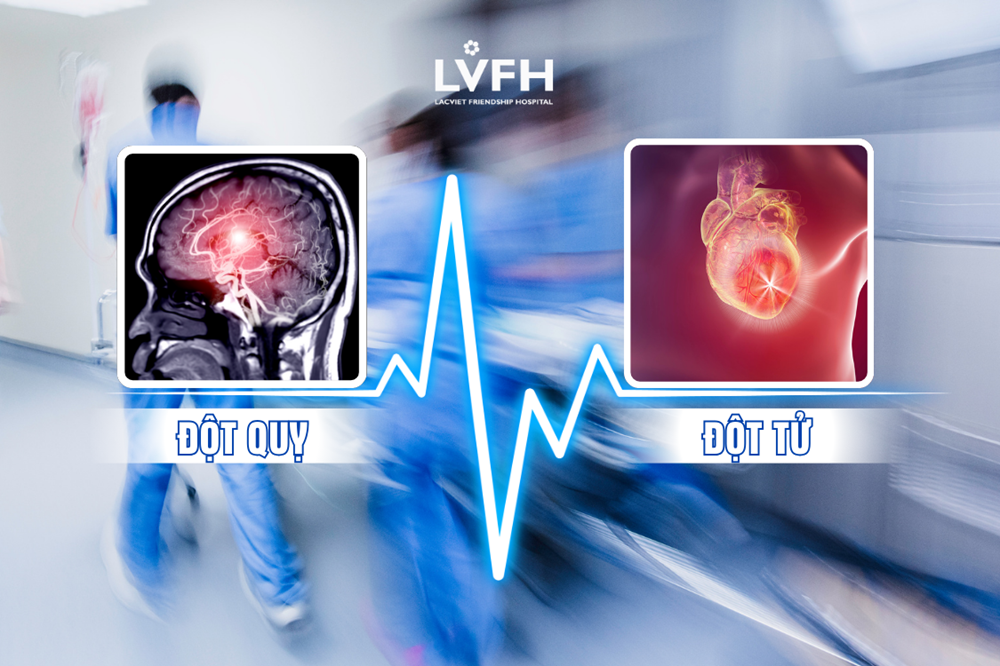 Đột quỵ và đột tử khác nhau: Cách phân biệt rõ ràng để cứu sống người bệnh 1 Đột quỵ và đột tử là hai tình trạng cấp cứu nguy hiểm, dễ bị nhầm lẫn do đều xảy ra đột ngột và có thể gây tử vong nhanh chóng.