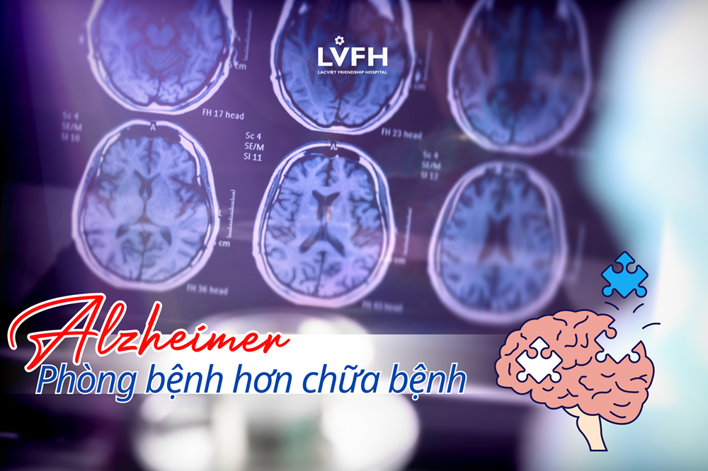 Alzheimer: Phòng bệnh hơn chữa bệnh