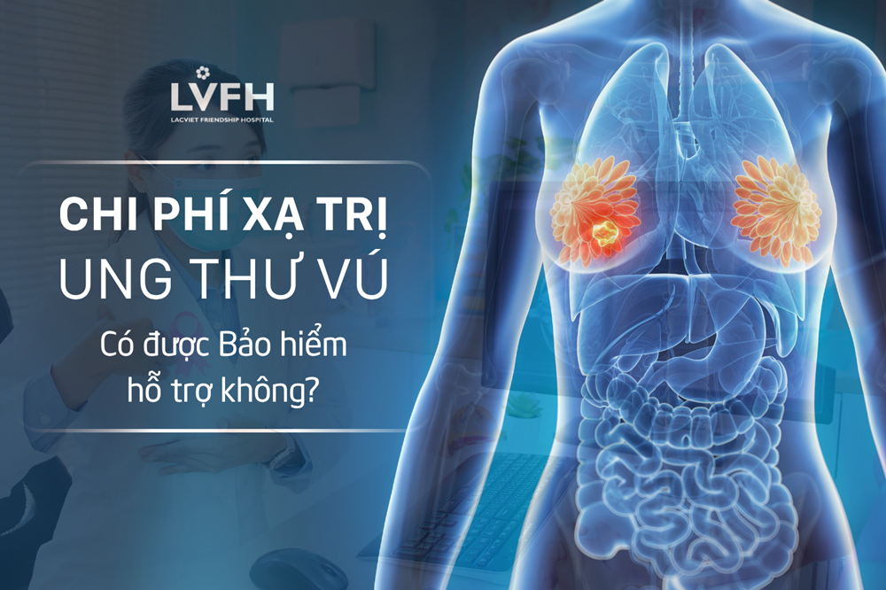 Chi phí xạ trị ung thư vú là bao nhiêu? Có được bảo hiểm hỗ trợ không?