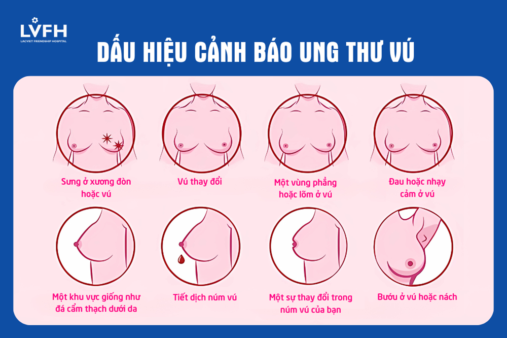 dau hieu canh bao ung thu vu