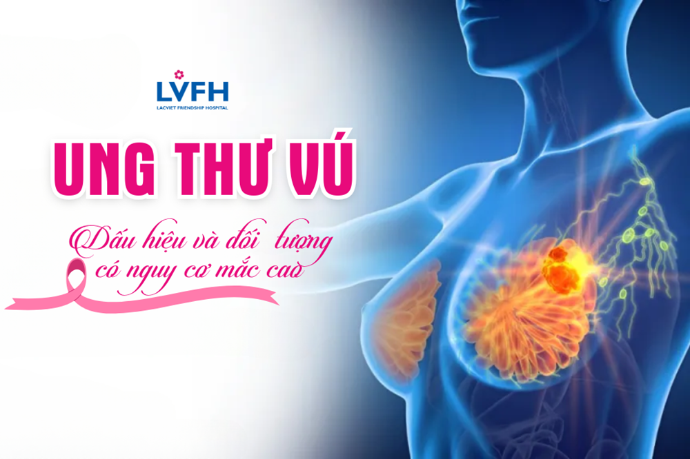 Dấu hiệu Ung thư vú và đối tượng có nguy cơ mắc cao