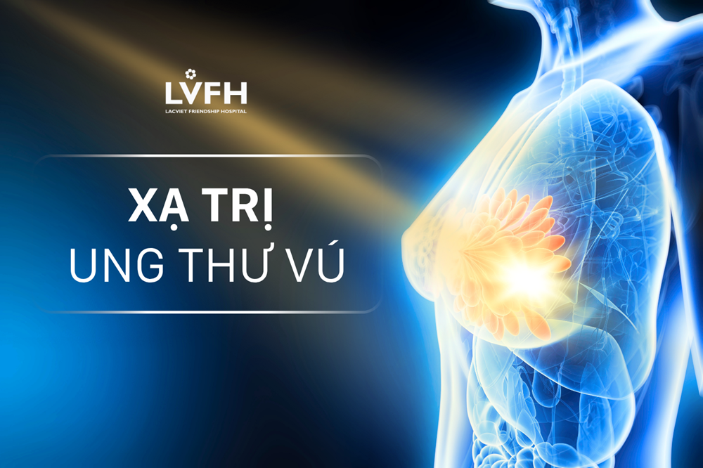 Khi nào nên xạ trị ung thư vú? Quy trình và những lưu ý