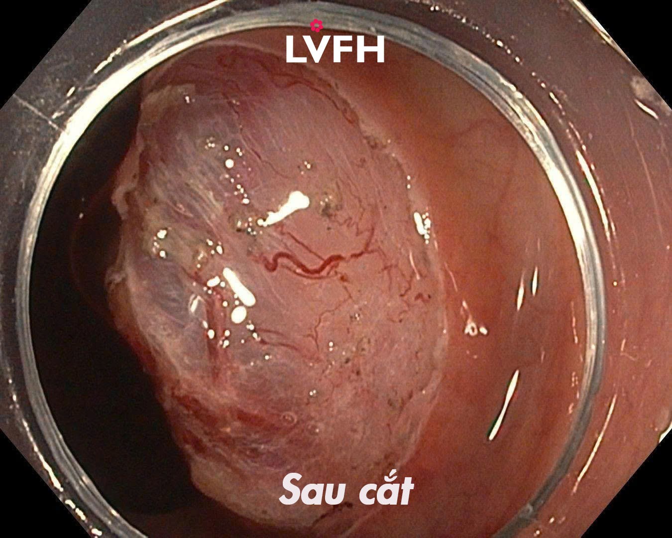 sau cat 1