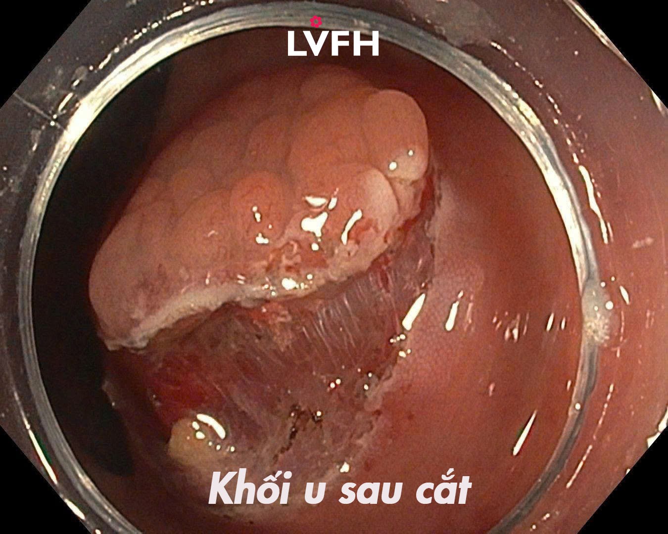 sau cat 2