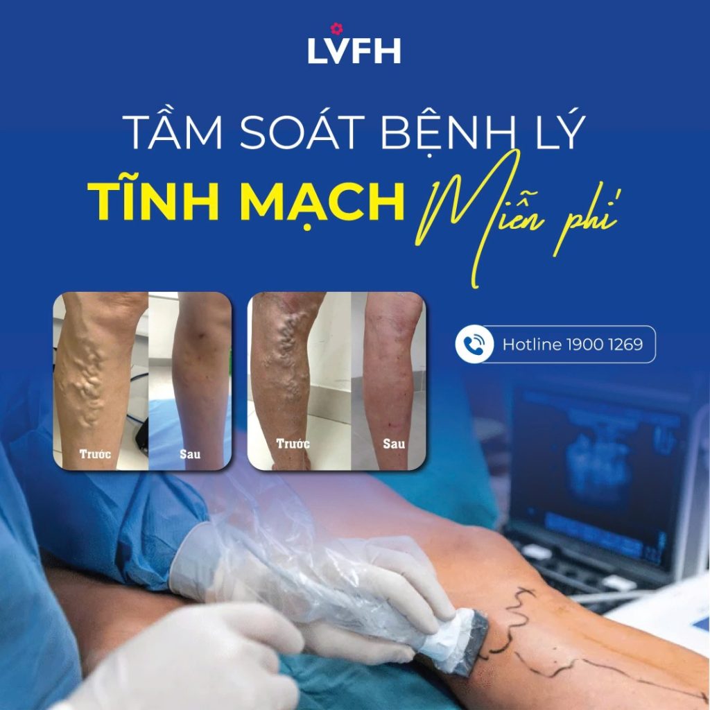 Cơ hội vàng: Tầm soát bệnh lý tĩnh mạch MIỄN PHÍ tại  Lạc Việt
